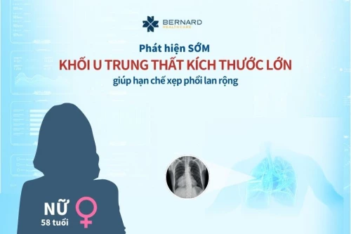 Phát hiện SỚM khối u trung thất kích thước lớn, giúp hạn chế xẹp phổi lan rộng